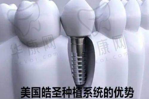 成都思迈口腔与其他口腔机构收费对比