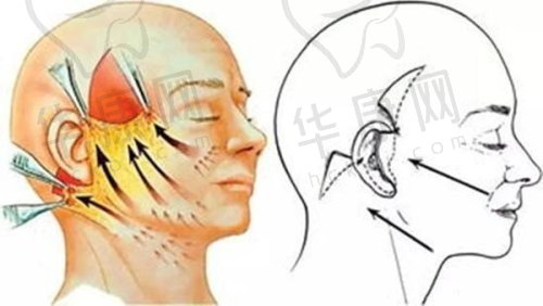 给其他求美者的建议