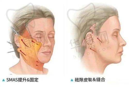 张建光医生的技术优势