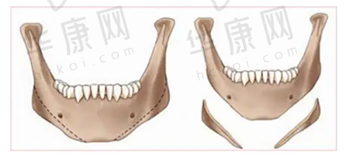 翟杨院长特色技术优势