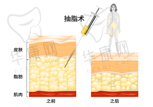 南宁帕拉美医疗美容医院的服务优势