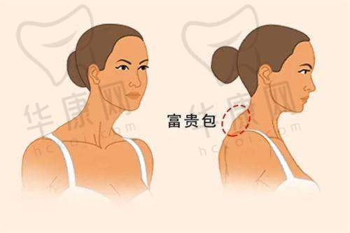 从资本结构看南宁华美私立特征