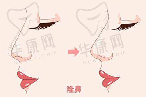 大连沙医生整形在大腿吸脂项目的特色优势