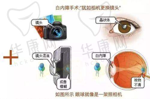 术后长期成效呈现