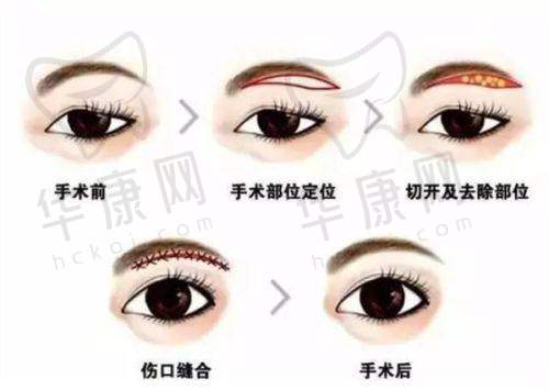 崔昌墉医生预约方式