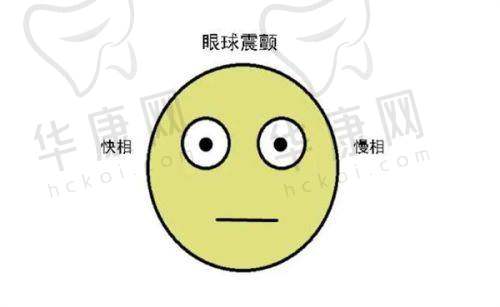 南宁佰视佳眼科陈良桔做3D全飞秒小切口SMILE手术，不贵技术好，助你告别模糊视界