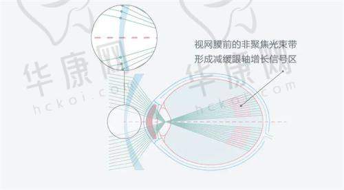 临沂新益民眼科医院医疗保险使用情况
