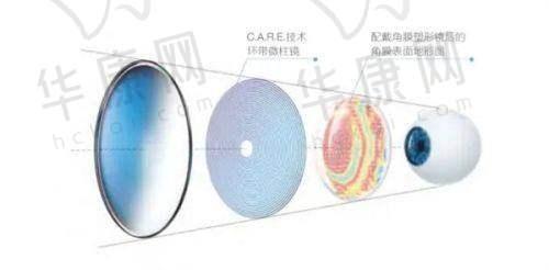 安顺光明眼科医院是不是正规的？二级资质、口碑好，多维度证实其正规靠谱