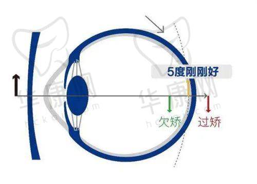 南京白内障手术最好医院是哪家？技术实力排名榜单助你精准选对