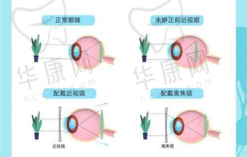 北京美尔目润视眼科医院的治疗项目