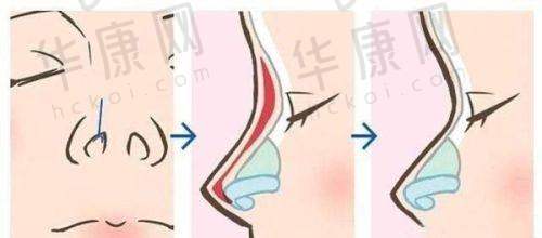 辽宁杏林整形外科医院朱石江医生预约方式