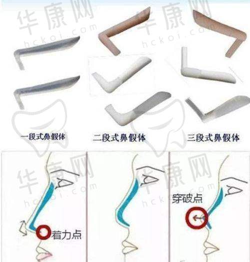 安徽维多利亚整形外科医院的特色项目