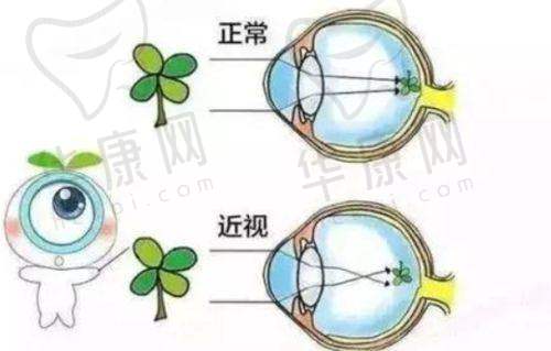 第五名：南京维视眼科医院