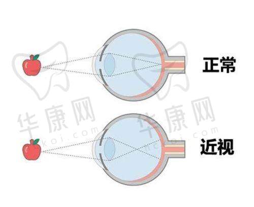 大同朝聚安康眼科医院关于术后护理须知