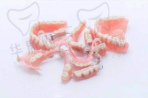 成都西南口腔医院半口活动义齿的医院优势