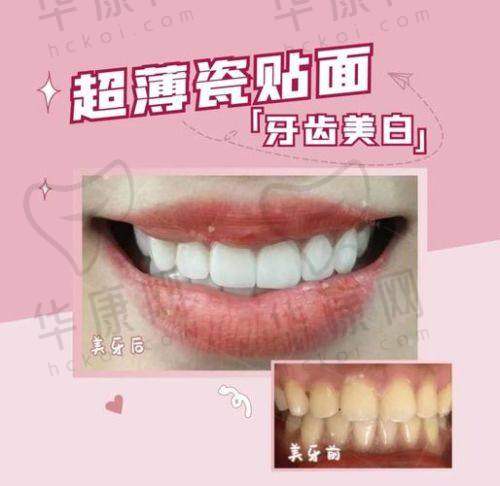 诊疗成效与感受