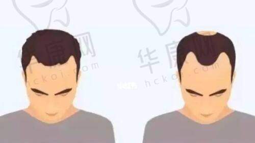 注射前的准备工作
