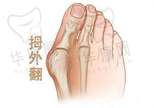 北京蒂凡妮美容医院的鼻部整形实例与口碑