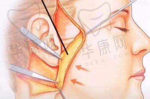 淄博壹美整形美容医院的口碑评价