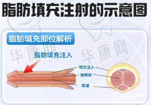 王晓斌医生特色技术优势