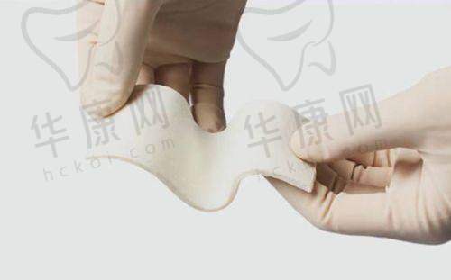 兰大二院美容科去红血丝光子嫩肤，美肤经历如何？