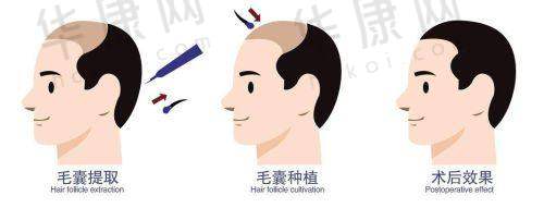 总结为何选择台州维多利亚医疗美容医院