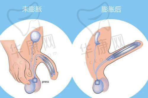 南京美莱和华美哪个医院更好？从多维度对比为你揭晓靠谱之选！