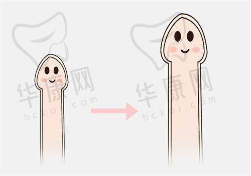 南通俪人连天美医疗美容医院钻石超声炮与其他美容项目的对比