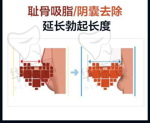 患者的真实反馈