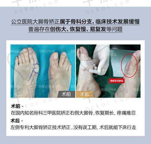 改善下巴后缩和宽有哪些手术方式？