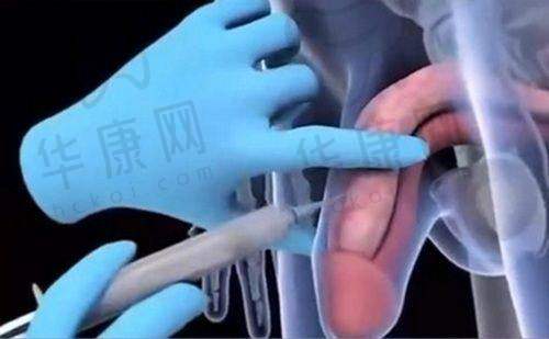 成都怡脂医疗美容医院的设备专精性