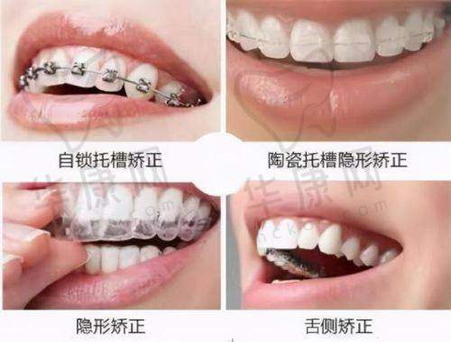 泰康拜博口腔靠谱吗?实力剖析