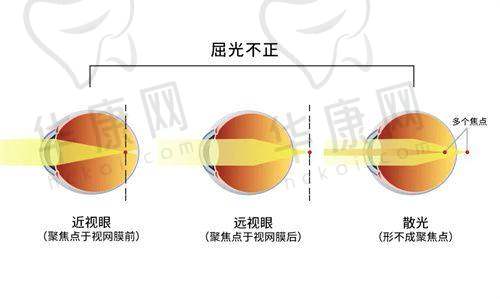 总结济源尖峰眼科医院的优势