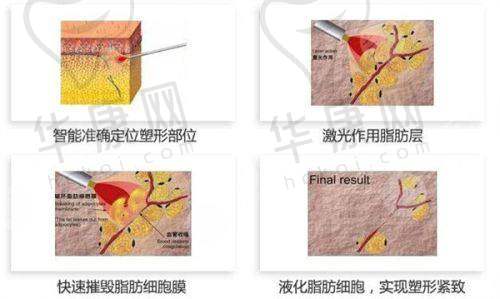 后续回访与持续成效