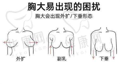 柳超医生擅长项目