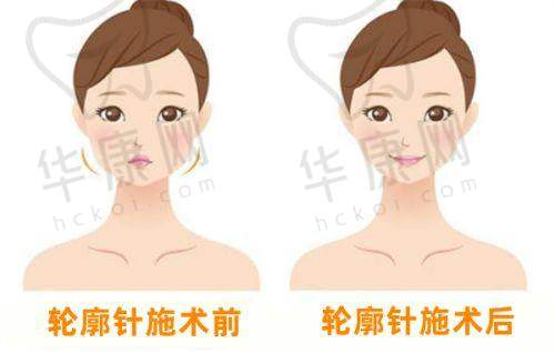 兰大二院美容科去红血丝光子嫩肤，医院怎么样？