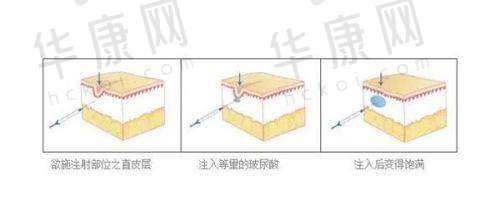 西宁时光整形美容医院优势总结