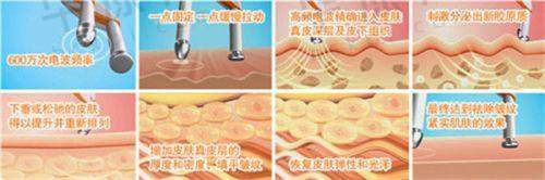 贵阳利美康医院做鼻子之价格情况