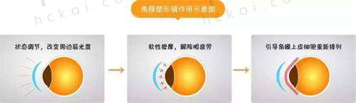 郑州爱尔眼科医院如何挂号?便捷方式全攻略