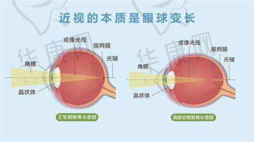 合肥沃瑞眼科医院的服务与项目