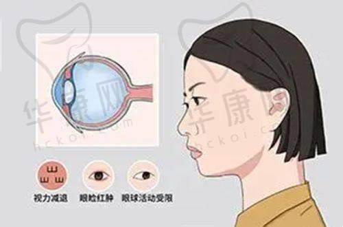 成都双楠医院眼科刘治容医生特色技术优势