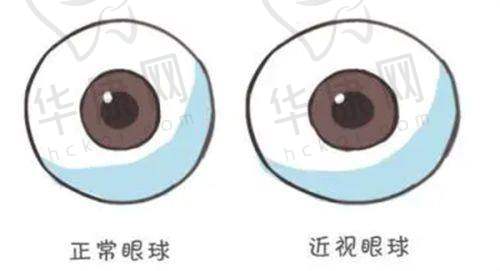 太原爱尔眼科医院的治疗项目