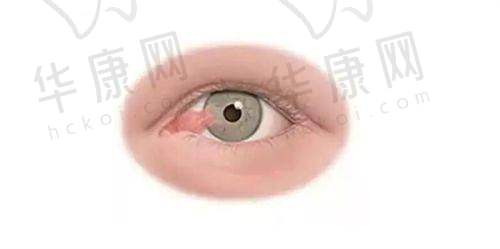 北京同仁眼科医院费用一键查询:如何看懂收费明细?
