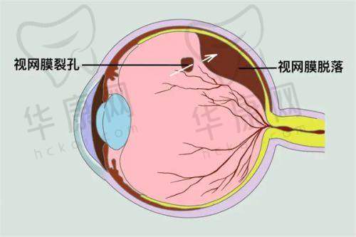 济源尖峰眼科医院的口碑