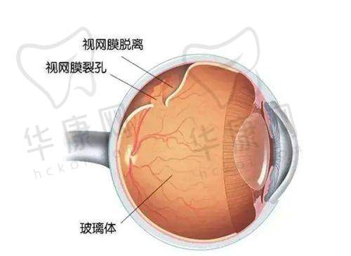 郑州爱尔眼科医院的口碑如何?患者评价来告诉你