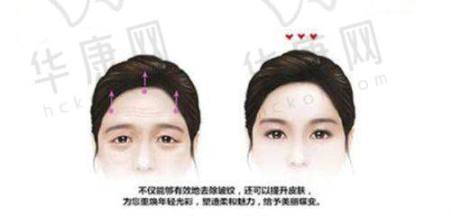 花1.7W体验的贴心感受
