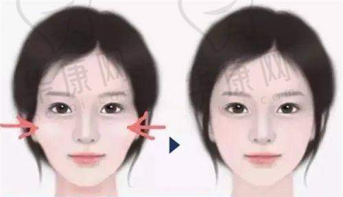 福州鼓楼爱美尔医疗美容腰腹部环吸的顾客反馈