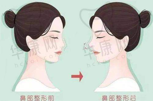 南通俪人连天美医疗美容医院埋线提升与其他医院的对比优势