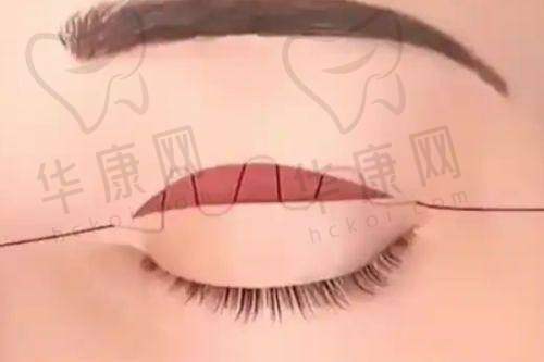非凡医生团队