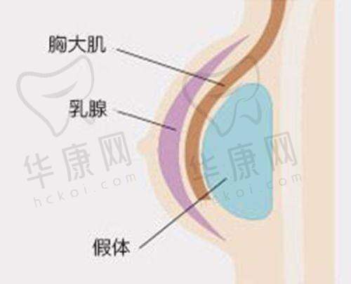 丁昆琨做拉皮手术有哪些独特特点?